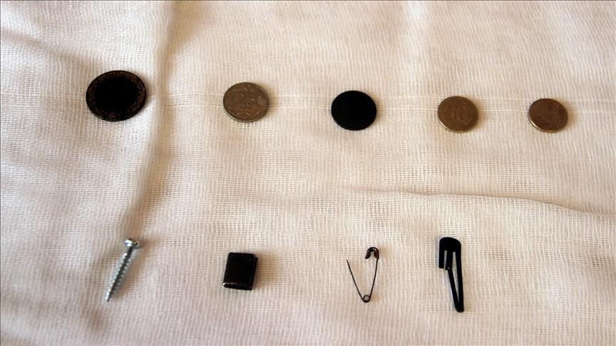 معرض في مستشفى تركي للجسيمات التي ابتلعها المرضى