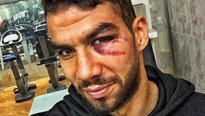 إكرامي ينشر صورة له بعد الجرح القطعي في الوجه