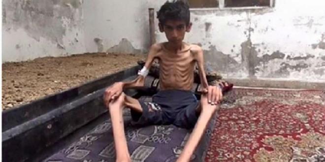 فورين بوليسي: الأمم المتحدة على علم بالوضع المأساوي في مضايا منذ شهور