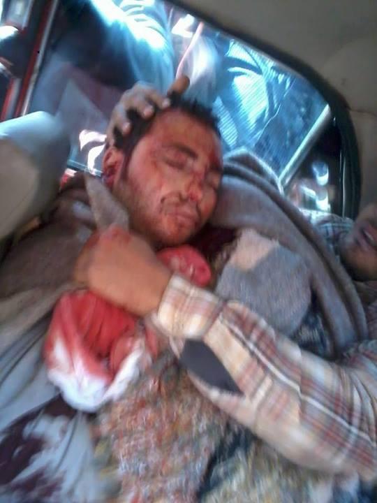 شهيد بطلق ناري فى مسييرة رافضة للانقلاب بالفيوم