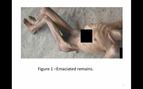 الأناضول تحصل على 55 ألف صورة لـ11ألف من ضحايا بشار