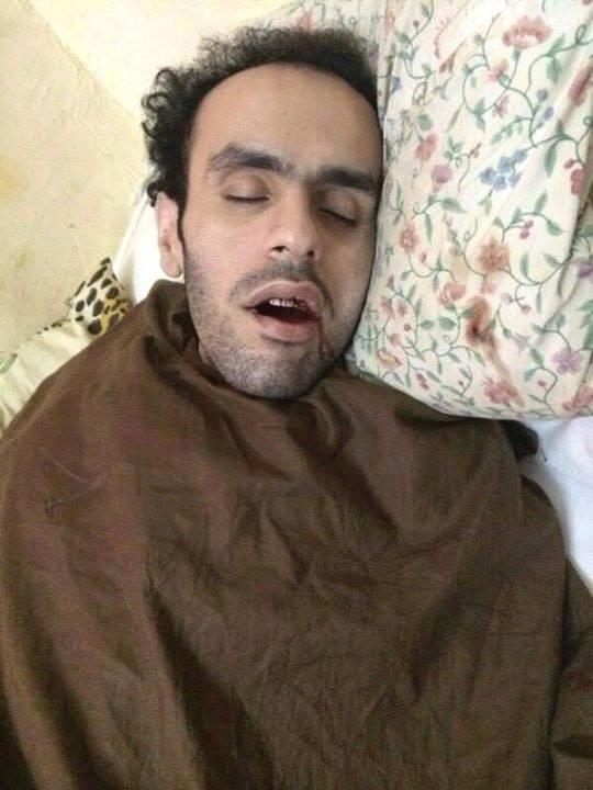 3أيام تفصل سلطان عن إتمام عامه الأول في الإضراب