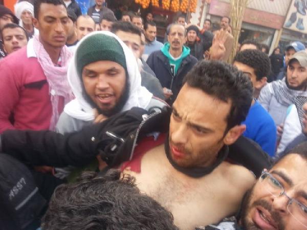 إصابة 3 متظاهرين بالرصاص الحى بمسيرة البحوث