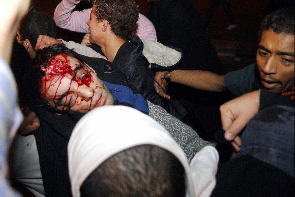 ارتقاء 3 من متظاهري “الألف مسكن” بالقاهرة