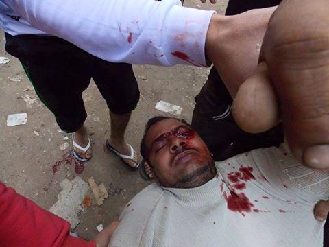 بالأسماء.. ارتفاع شهداء معارضي الانقلاب  لـ13