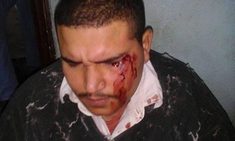 ‫مدير وردية يعتدي على عامل ويصيبه بنسيج كفر الدوار