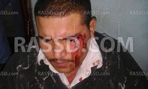 مدير وردية يعتدي على عامل ويصيبه بنسيج كفر الدوار