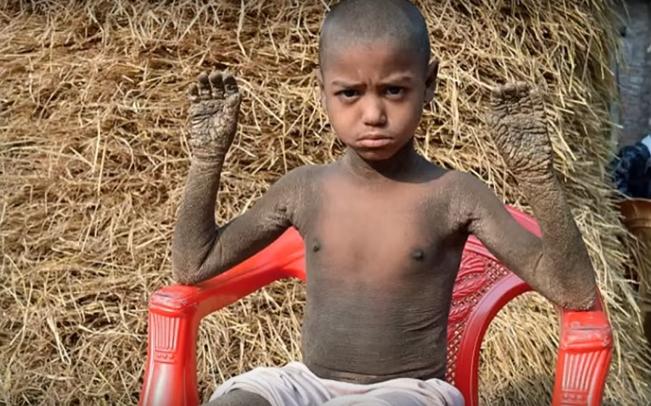 بالفيديو.. طفل متحجر حبيس منزله منذ 8 سنوات