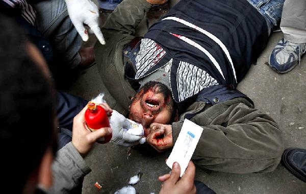 مستشفي ميدانى لعلاج مصابى”القبة” والأمن يتراجع امام القصر