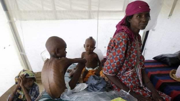 المجاعة تجتاح عددا من الدول وتهدد حياة مليون ونصف طفل