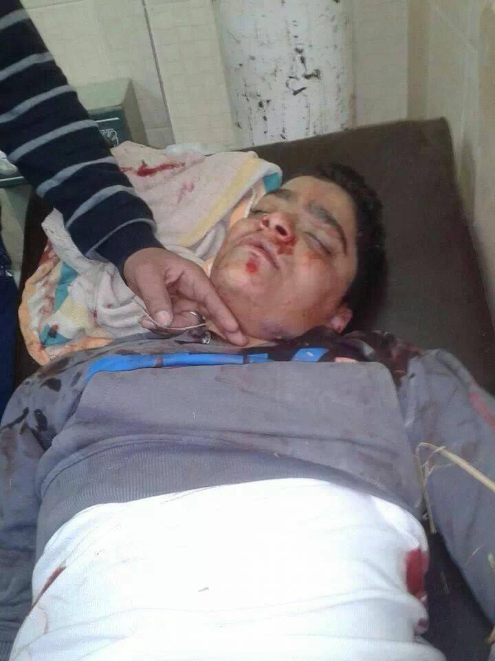 استشهاد أحد مؤيدي الشرعية في الإسكندرية