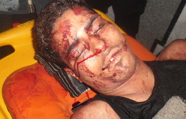 39 مصاب حصيلة اشتباكات التحرير اليوم