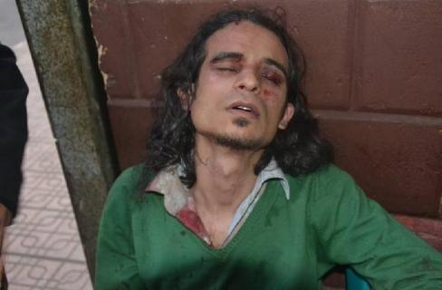 مطالب بتفعيل قانون حق المصور في ممارسة عمله بحرية