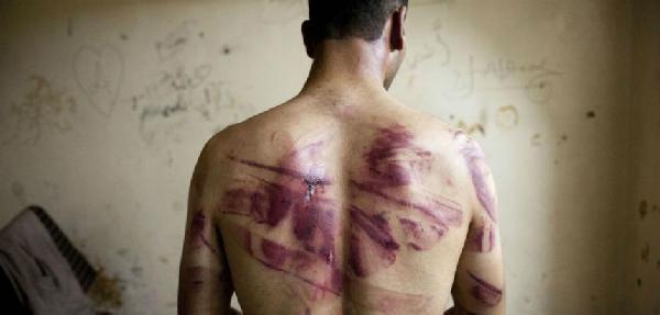 الأمن يعتدي على معتقلي الكيلو 10.5 بالهراوات والعصي الحديدية