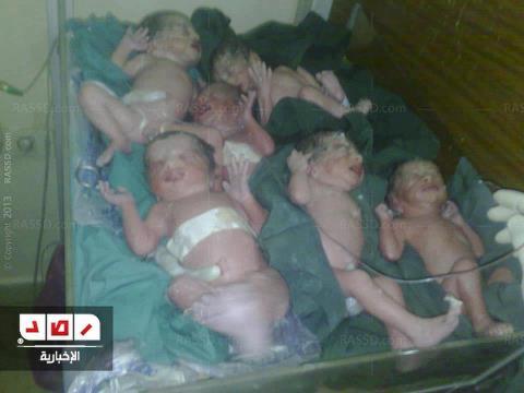 بالفيديو ..إمرأة تلد 6 توأم بالمنيا