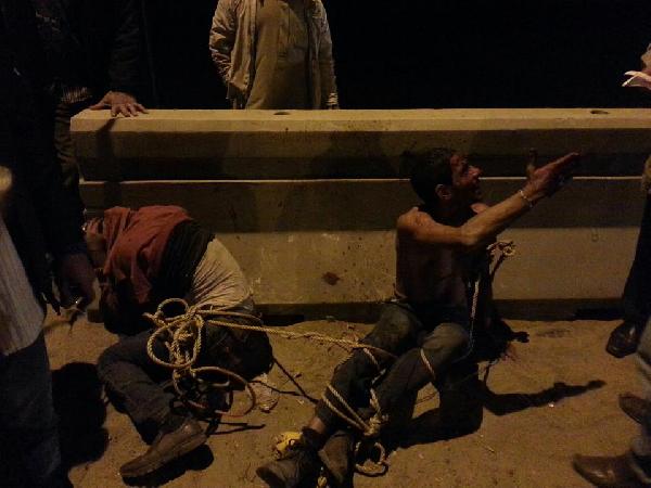 القبض على بلطجية حاولوا سرقة سائق تاكسي بعد قطع يده بالمحور