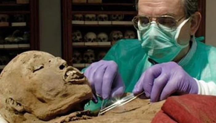 اكتشاف أقدم إصابة بسرطان الثدي في مصر قبل 4200 عامًا