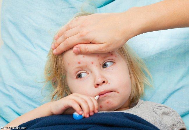 تنظيم المؤتمر السنوي لمكافحة الدرن بالبحيرة