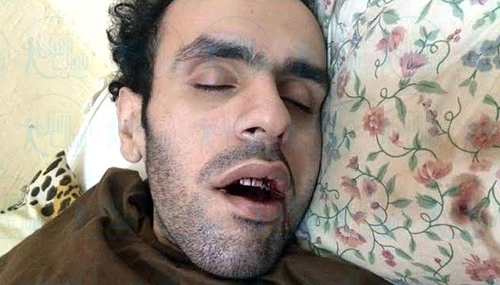 سلطان يواصل إضرابه عن الطعام لليوم 432 على التوالي