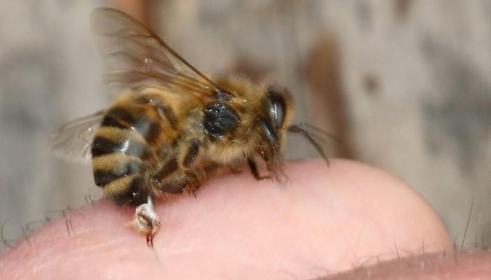 خبيرة: لسعة النحل تعزز مناعة الجسم