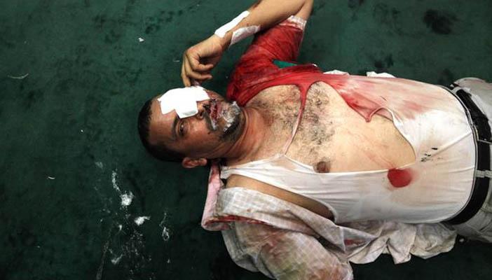 الداخلية تعترف بالتعذيب.. وحقوقيون: محاولة لتجميل الصورة