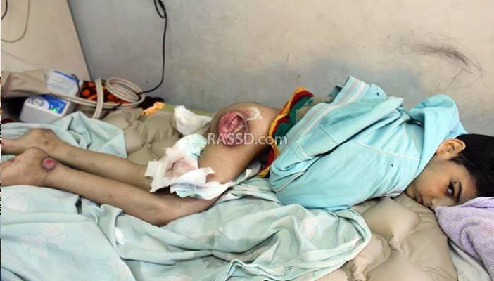 أم مكلومة تحكي مأساة فلذة كبدهاالوحيد الذي بات عاجزا بيد الإهمال الطبي