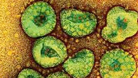 إقالة وزير الصحة السعودي عقب وفاة 81 حالة بـ”كورونا”