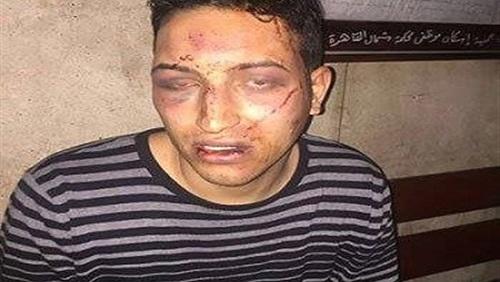 بالفيديو.. “الفيومي” يروي واقعة إطلاق الرصاص عليه من قبل ضابط الشرطة