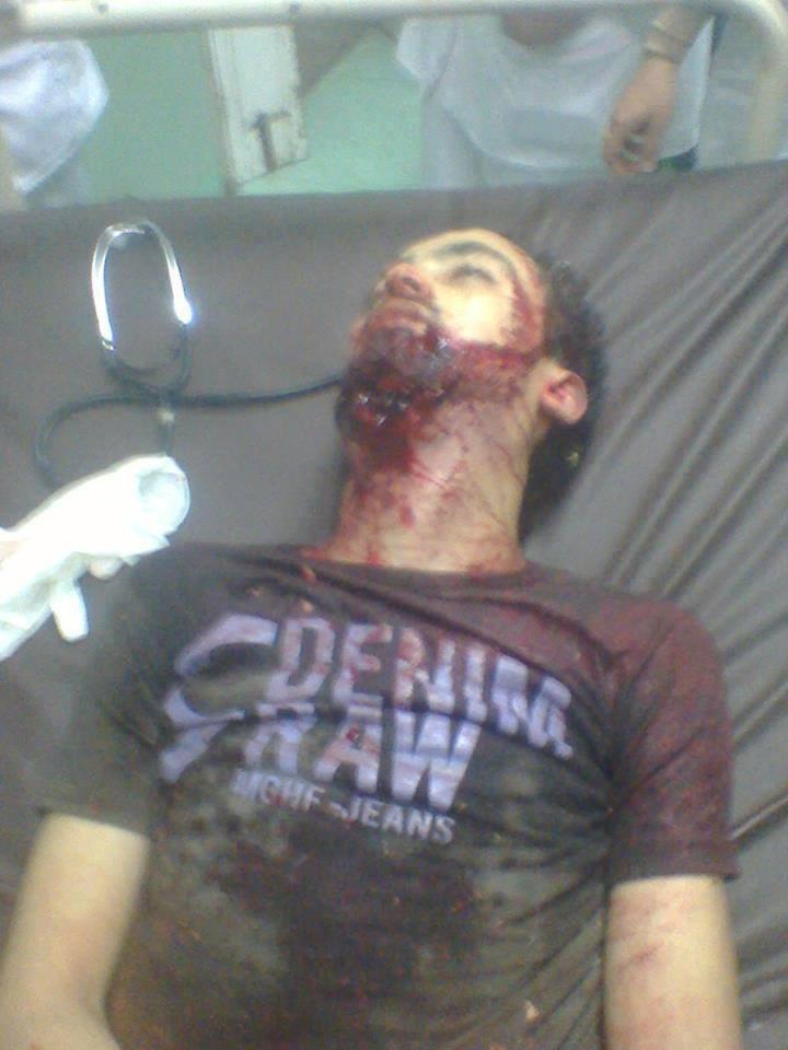 مقتل شخص جراء اعتداء بلطجية على مسيرة بـ”الخياطة” بدمياط