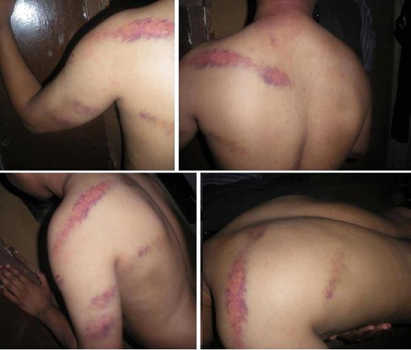 مطالب حقوقية بالتحقيق في تعذيب الشرطة لطلاب الأزهر بالكرابيج