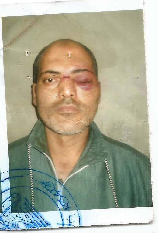 “رصد” تكشف تعرض معتقل للتعذيب في سجون الانقلاب بالدقهلية