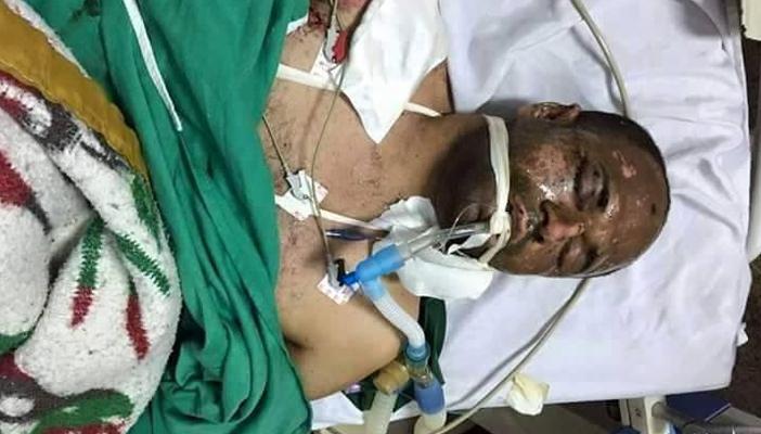 أمن البحيرة يتسبب في مقتل شاب وبتر ساق آخر