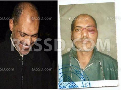 تعذيب مواطن بالدقهلية لإجباره على الاعتراف بتهمة “الإرهاب”