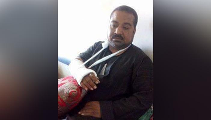 بعد إصابته بكسر مضاعف.. مواطن يتقدم ببلاغ إلى النائب العام ضد الشرطة