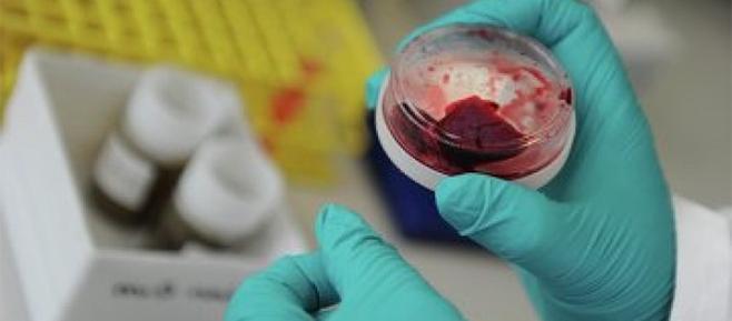 ارتفاع الحالات المصابة بـ “كورونا” في السعودية لـ ١٦٣ شخصَا