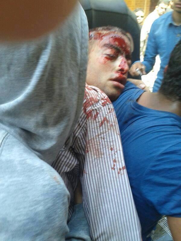 ارتقاء شهيد برصاصة في الرأس بمسيرة المطرية