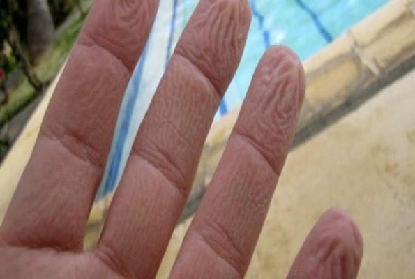 بالفيديو.. تعرف على أسباب تجعد الأصابع عند تعرضها للماء