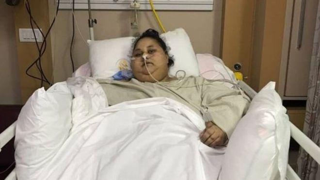 تطوّر الحالة الصحية لـ”أسمن فتاة في العالم” بأبو ظبي