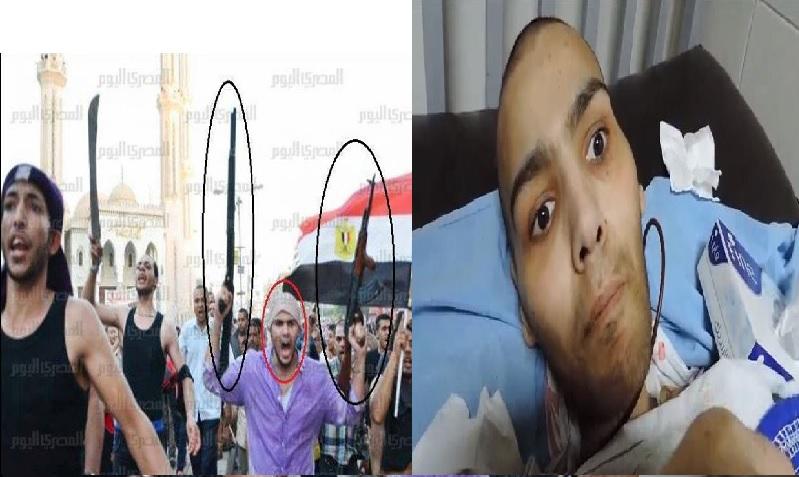 صور | تدهور حالة البلطجي قاتل نساء المنصورة