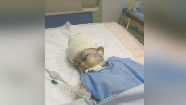 التقرير الطبي لـ”طفل المطرية”: مصابٌ بنزيف في المخ وتهتك في الرئتين