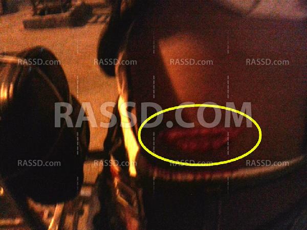 إصابة أحد رافضي الانقلاب بـ”مطواة” بلطجية السيسي في أسوان