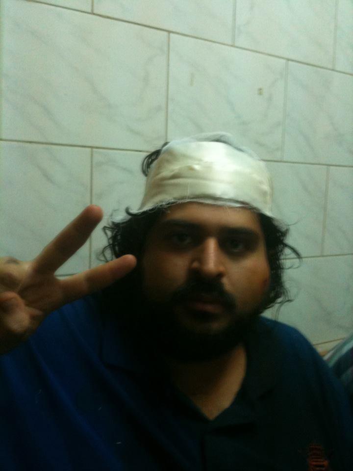 المغير بعد الاعتداء عليه:مصاب وانزف لكن معنوياتي مرتفعه