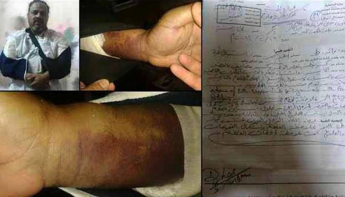 “الأوروبي” يرسل استغاثة قبل بتر ذراعيْ “طلعت” في طره