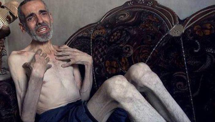 بالصور.. معاناة السوريين بالغوطة.. الجوع والموت هما السائدان