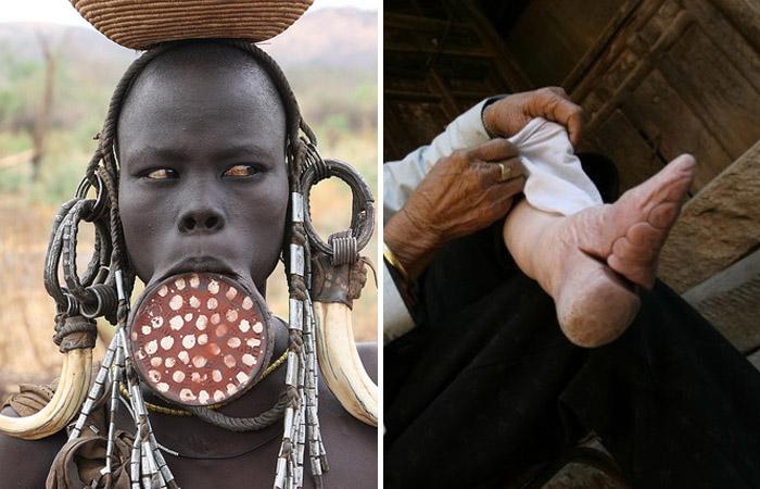 بالصور.. عمليات التجميل الأكثر غرابة في العالم على مر العصور