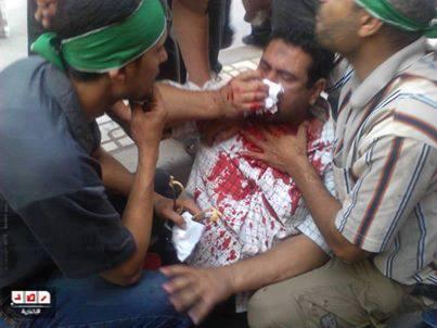 اعتداء مجهولين علي مسيرة في المنصورة بالخرطوش