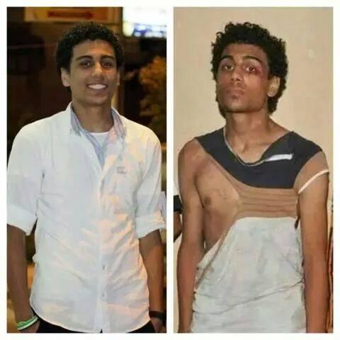 أسرة طالب معتقل ببورسعيد تكشف تعرضه للتعذيب