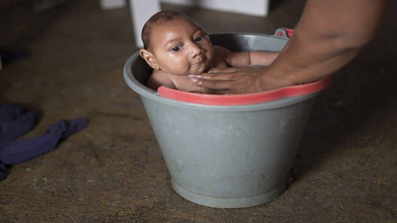 ولادة 3 أطفال جدد في أميركا عليهم أعراض الإصابة بفيروس زيكا