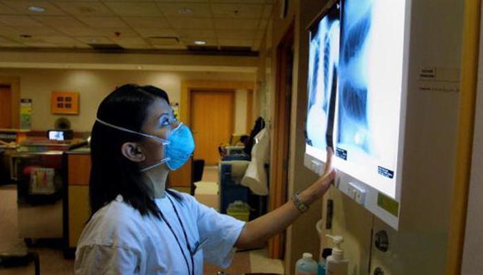 نجاح علاج جيني للتليف الرئوي الكيسي