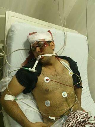 إصابة أحد رافضي الانقلاب بـ3 طلقات بالرأس بمسيرة “المطرية”